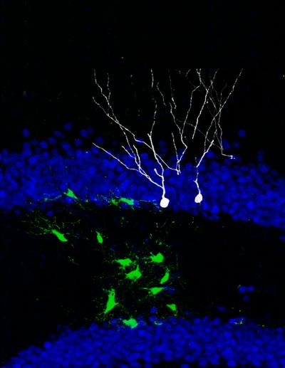 Neural Stem Cells Reprogrammed - While Still In The Brain!
